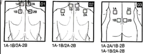 نقشه قرارگیری الکترودها روی بدندستگاه فیزیوتراپی بیورر Beurer EM80 (TENS/EMS/Massage)