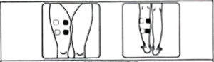 محل قرارگیری پدهای الکترود در ناحیه پا برای دستگاه تحریک عضلانی و فیزیوتراپی EMS جامپر مدل JPD-ES220 — k-teb.com