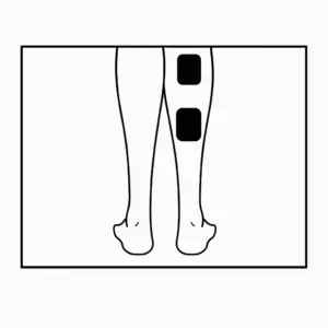 تصویر محل قرارگیری پدهای دستگاه تنس هابدیک دو کاناله بر روی عضلات ساق پا – فایل اختصاصی کیهان طب K-TEB.COM