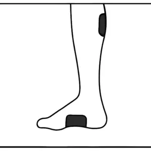 محل قرارگیری پد دستگاه تنس هابدیک HubDIC روی ساق پا و کف پا برای درمان درد عضلانی – مناسب برای دستگاه ۲ کاناله TENS EMS 