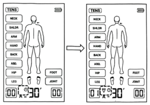 هشدار جدا شدن پد در دستگاه الکتروتراپی Jumper JPD-ES220 – نمایش نماد پد روی صفحه‌نمایش
